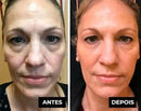 Creme Lifting Firmador Tensor de Rugas em 60 segundos