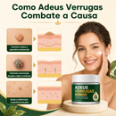 Adeus Verrugas Creme [COMPRE 1 LEVE 2] + Frete Grátis