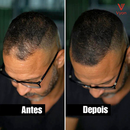 Premium Power Hair - Homem