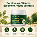 Adeus Verrugas Creme [COMPRE 1 LEVE 2] + Frete Grátis
