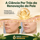 Adeus Verrugas Creme [COMPRE 1 LEVE 2] + Frete Grátis