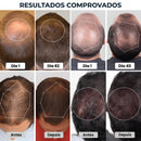 HairLux™ Pro - Tecnologia LED para Crescimento Capilar